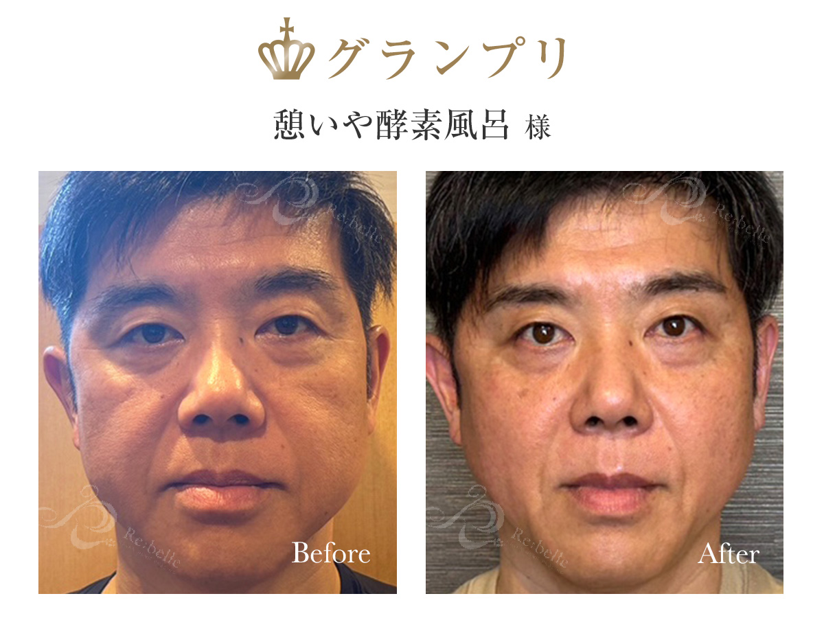 グランプリ受賞写真