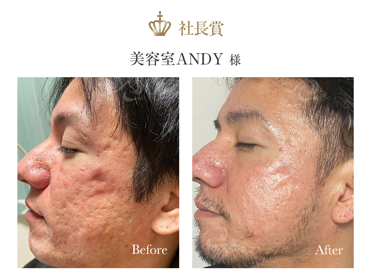 社長賞受賞写真