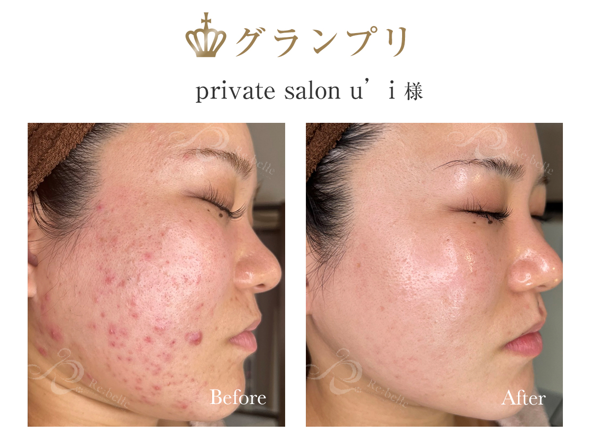 グランプリ受賞写真