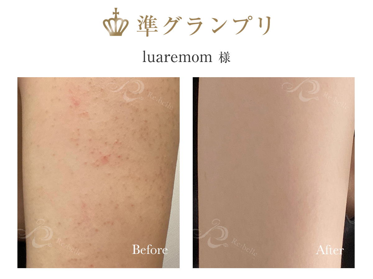 準グランプリ受賞写真