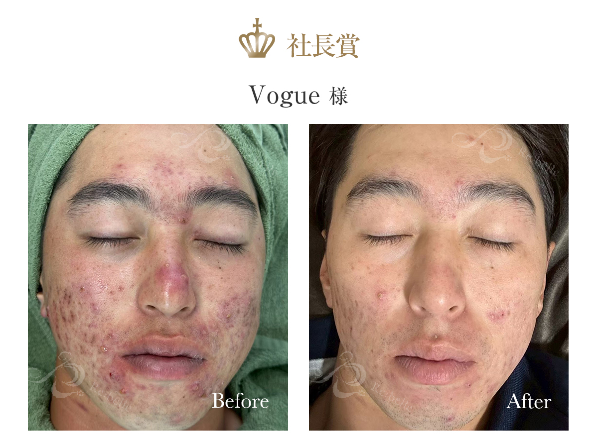 インストラクター賞